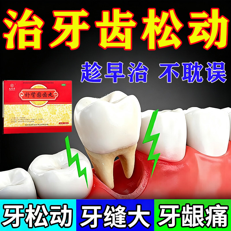 九芝堂补肾固齿丸正品牙齿松动特专用效药牙周炎牙根外露牙缝宽大