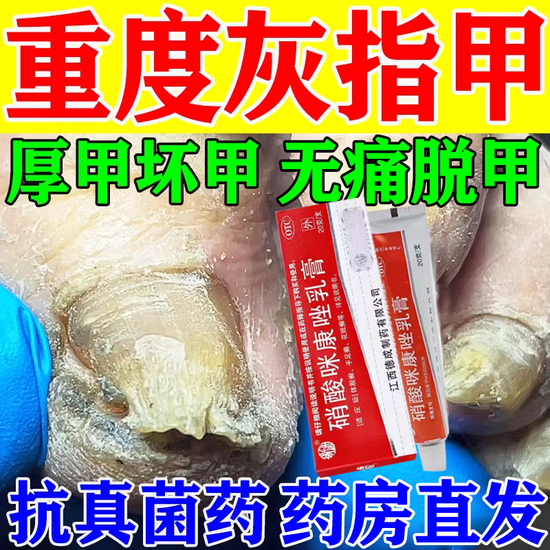 亮灰指甲特专用效药甲癣正品旗舰店专治疗去水膏脱甲除真菌感染药