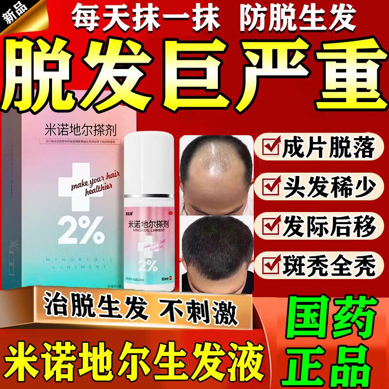 【达霏欣】米诺地尔搽剂2%*30ml*1瓶/盒