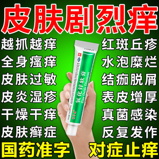 氧化锌软膏正品湿疹药膏皮肤瘙痒外用止药痒顽固皮炎特皮肤溃烂效