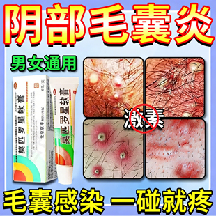 莫匹罗星软膏正品官方旗舰店治疗私处瘙痒毛囊炎止痒专用抑菌药膏