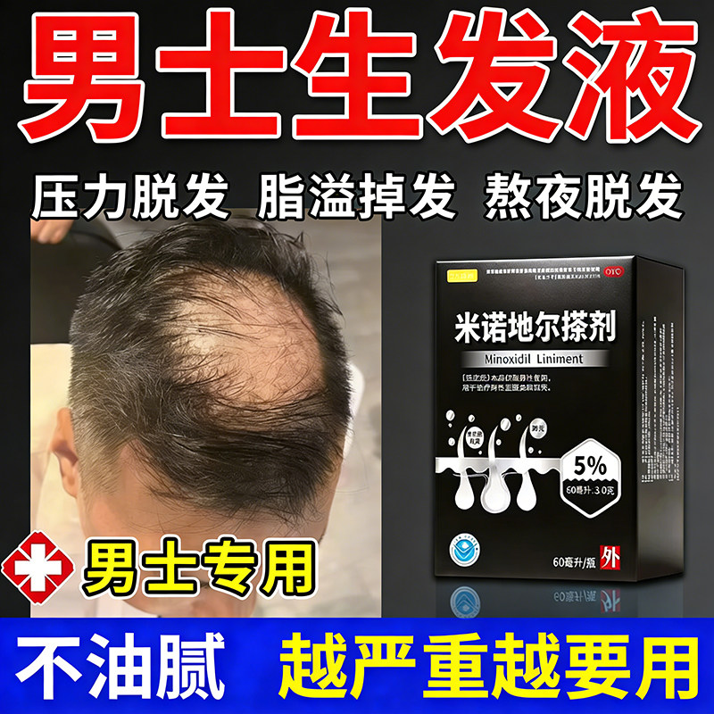 米诺地尔搽剂生发液官方旗舰店治疗男士男性脱发斑秃防脱增发