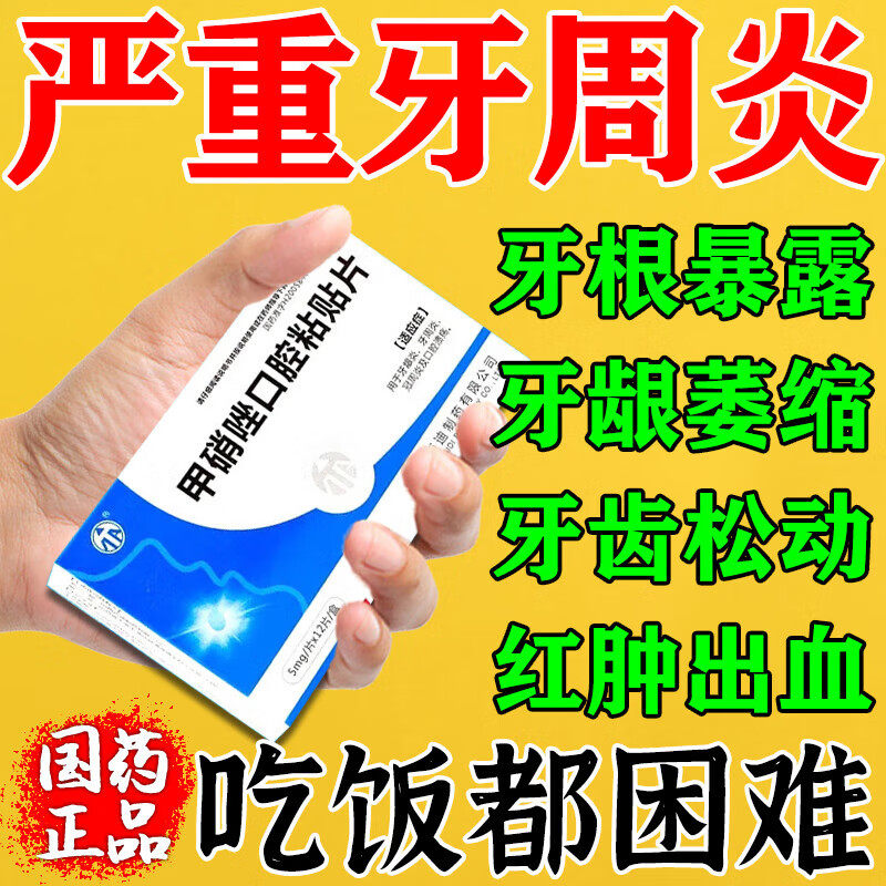 甲硝唑牙周炎片治牙痛专用药牙特疼止疼药消炎止痛牙龈肿痛效药贴