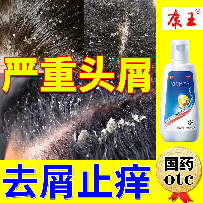 康王头皮屑严重去头屑专用药酮康唑洗剂去屑止痒洗发水旗舰店正品