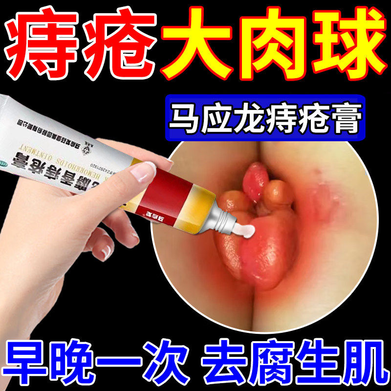 马应龙痔疮膏正品痔疮专用药消肉球内痔外痔混合痔大便出血肛裂疼