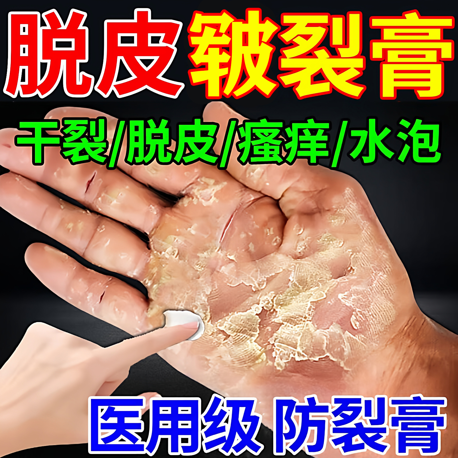 尿素乳膏正品官方旗舰店医用脚后跟干裂起硬皮足跟开裂真菌专用药