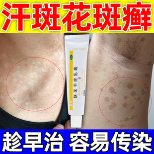 治汗斑花斑癣特专用效药手癣体皮肤真菌感染腋下斑点联苯苄唑乳膏