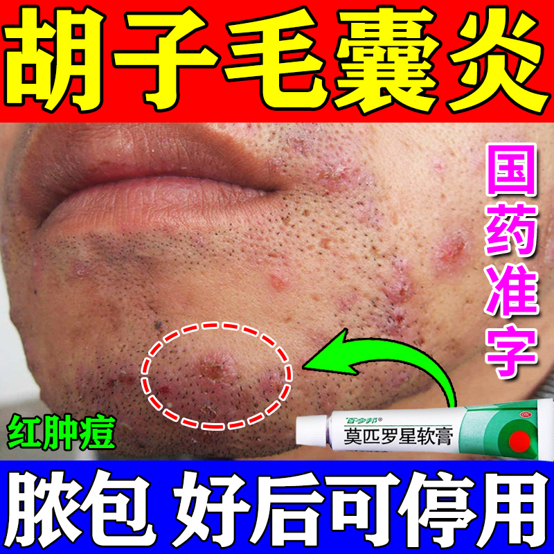 【百多邦】莫匹罗星软膏2%*10g*1支/盒