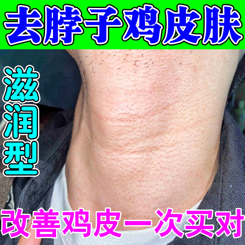 脖子鸡皮去除颈部粗糙红点毛囊角化长疙瘩疏通毛孔深层清洁保湿