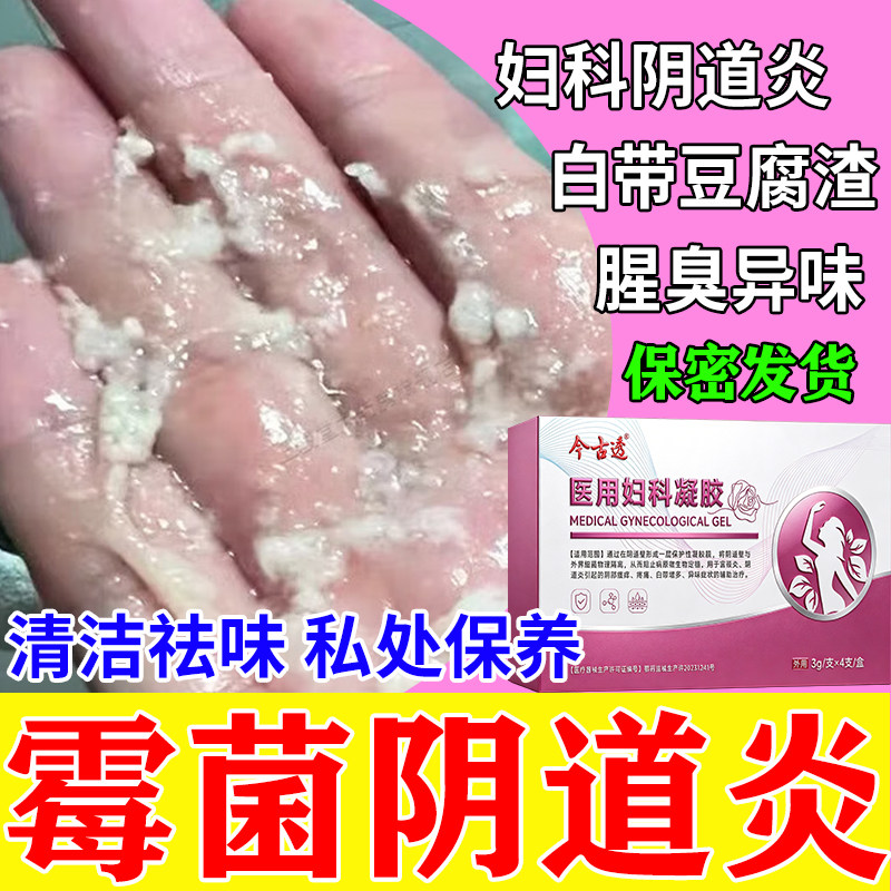 霉菌性阴道炎妇科凝胶豆腐渣反反复复白带多外阴痒专用益生菌洗液