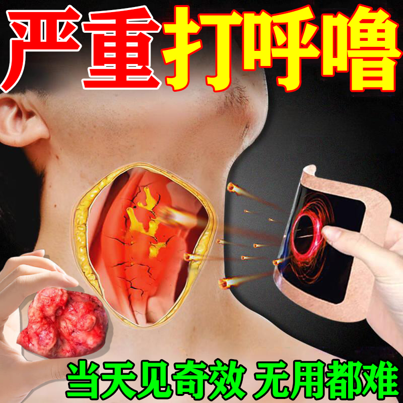 止鼾神器打呼噜止鼾器男女士儿童睡觉防打呼噜憋气重度专用止鼾贴