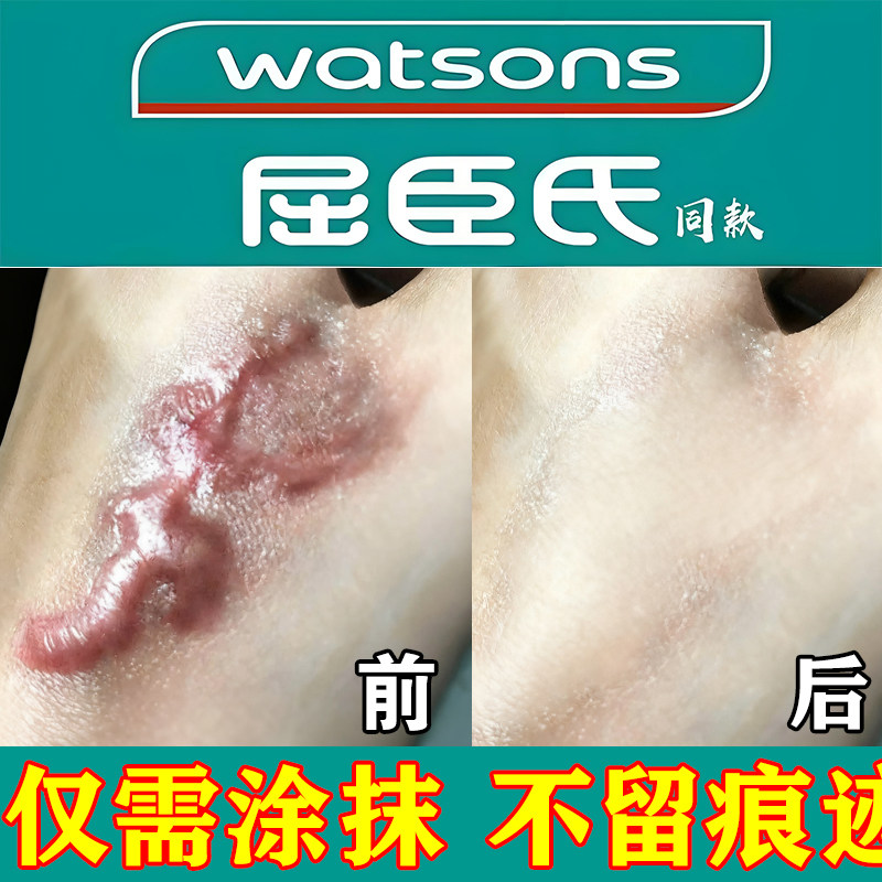 疤痕增生凸起去除疙瘩瘢痕手术剖腹产止痒淡化疤痕凝胶修复祛疤膏