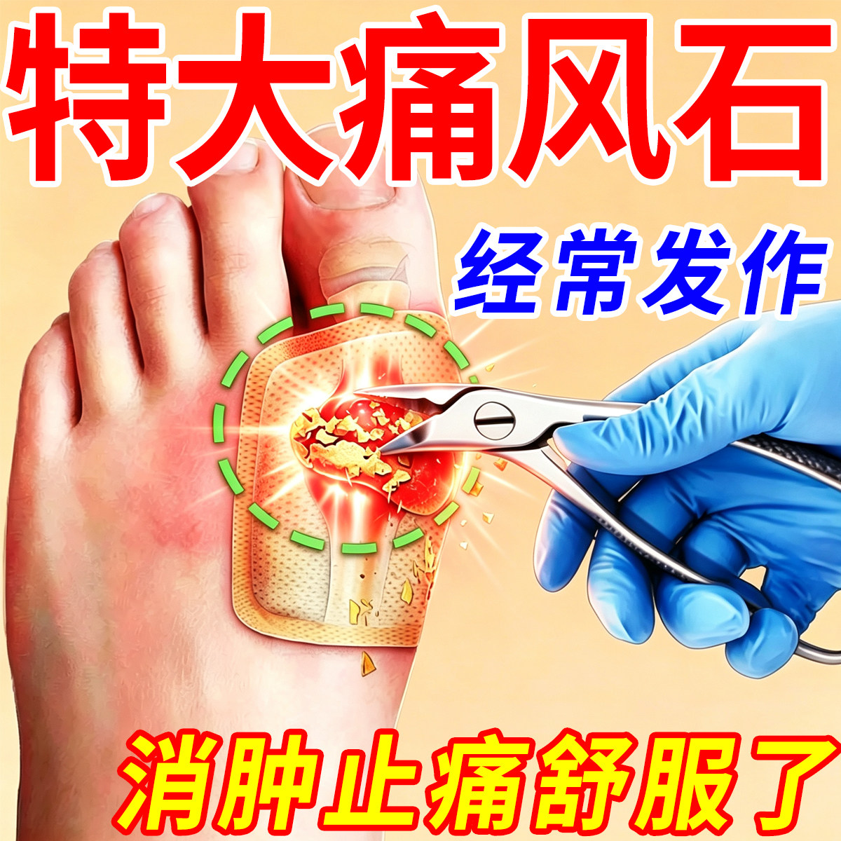 痛风降尿酸溶石去结晶消肿止痛脚指趾关节肿胀疼痛大鼓包变形膏贴