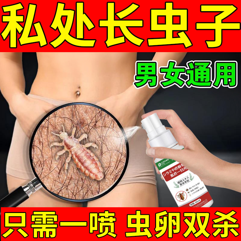 阴虱专用男女士私处瘙痒红疹阴毛痒灭虱虫卵螨虫一扫光虱立净喷剂
