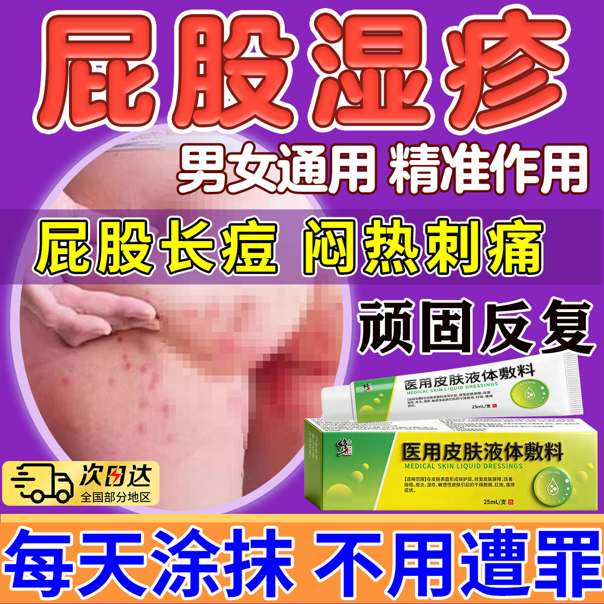 屁股湿疹长痘痘痒起热疙瘩湿疹慢性股藓久坐板疮红肿疙瘩火疖子膏