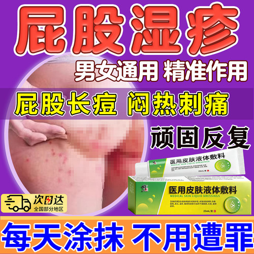 屁股湿疹长痘痘痒起热疙瘩湿疹慢性股藓久坐板疮红肿疙瘩火疖子膏