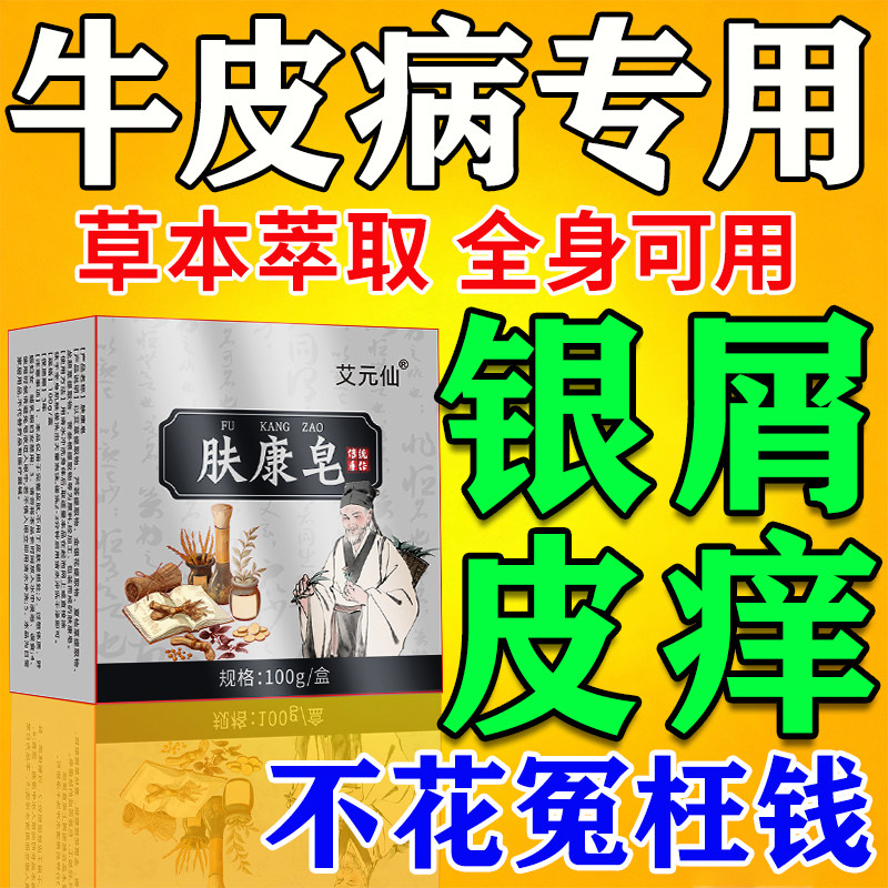 牛皮藓银屑病专用皂顽固性皮肤癣痒股藓体癣脚癣真菌感染杀菌止痒
