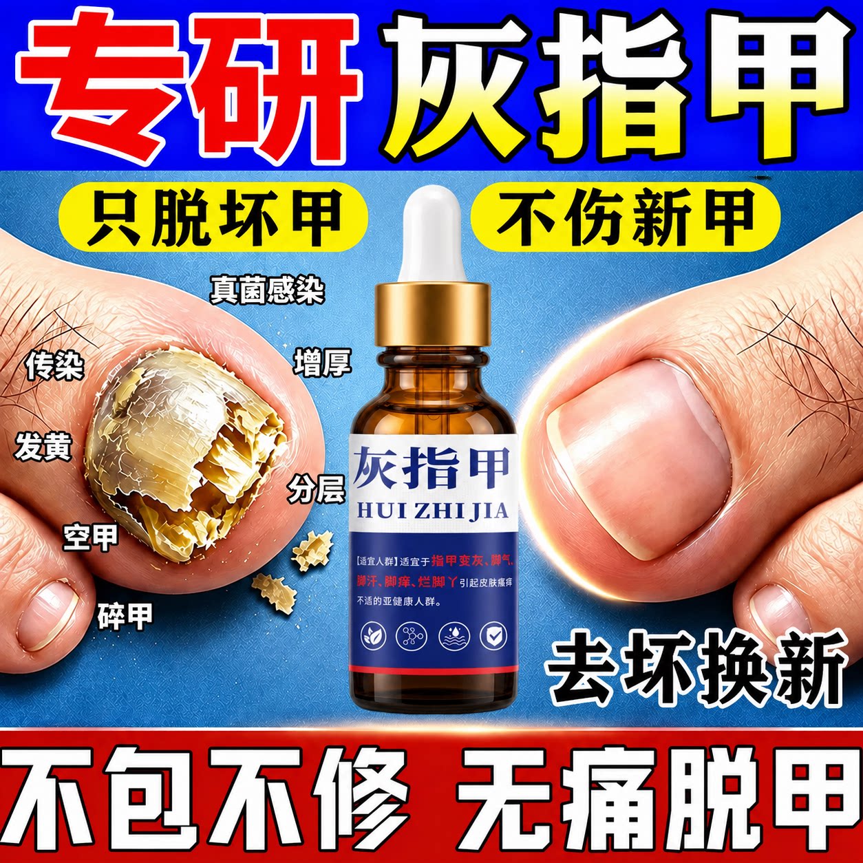 灰指甲专用真菌感染黑指坏甲空甲指甲增厚发硬发黄脱甲去除抑菌液