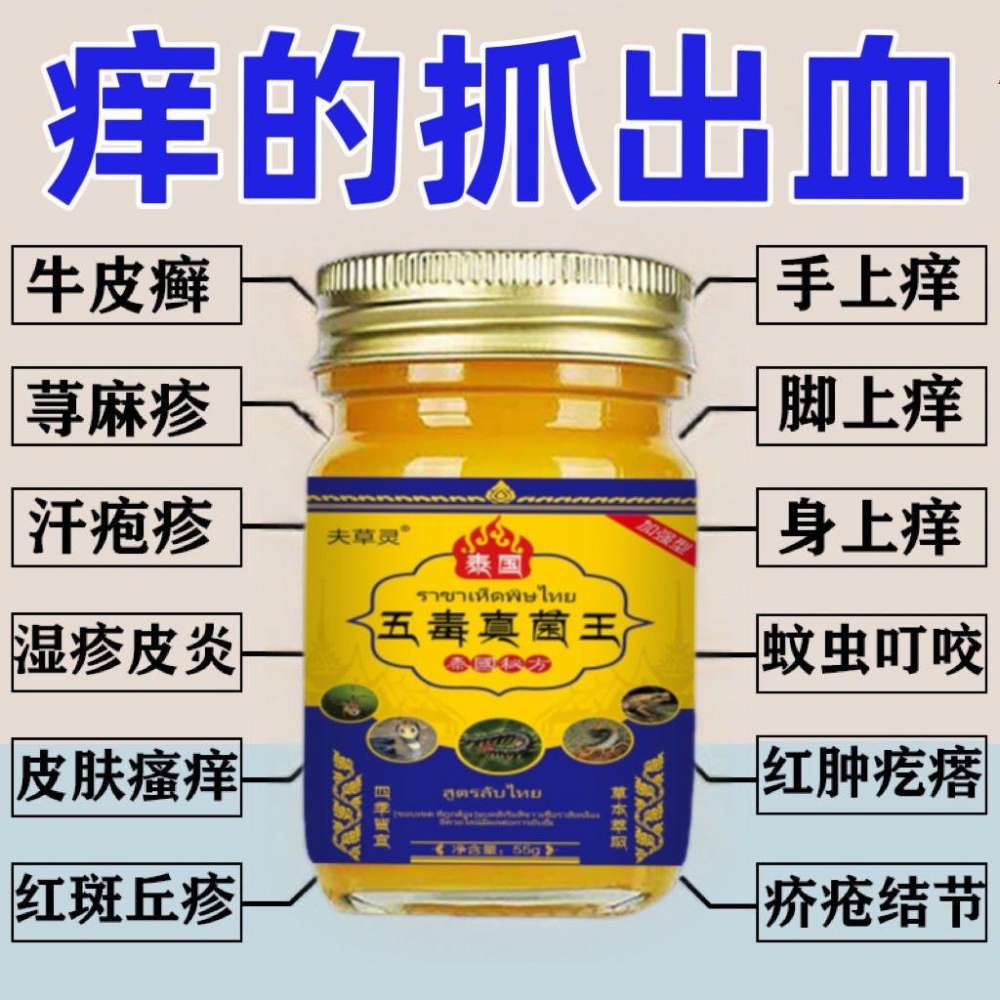 牛皮银屑癣皮肤瘙痒止痒膏