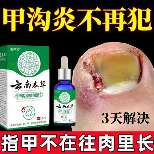 甲沟炎治疗专用特药膏效息肉去除药嵌甲克星脱指甲刀液软化剂神器