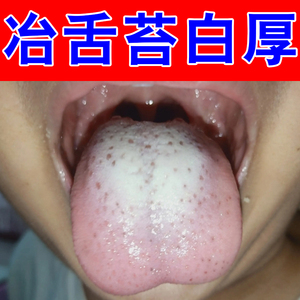 舌苔厚有齿白厚黄腻痕调除口臭去口腔异调理脾脾味口苦口干药喷剂
