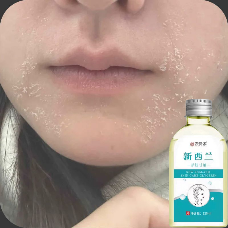 嘴周掉屑脸部干燥起皮掉皮掉皮脸爆皮起皮皮肤粗糙换季干燥季节性