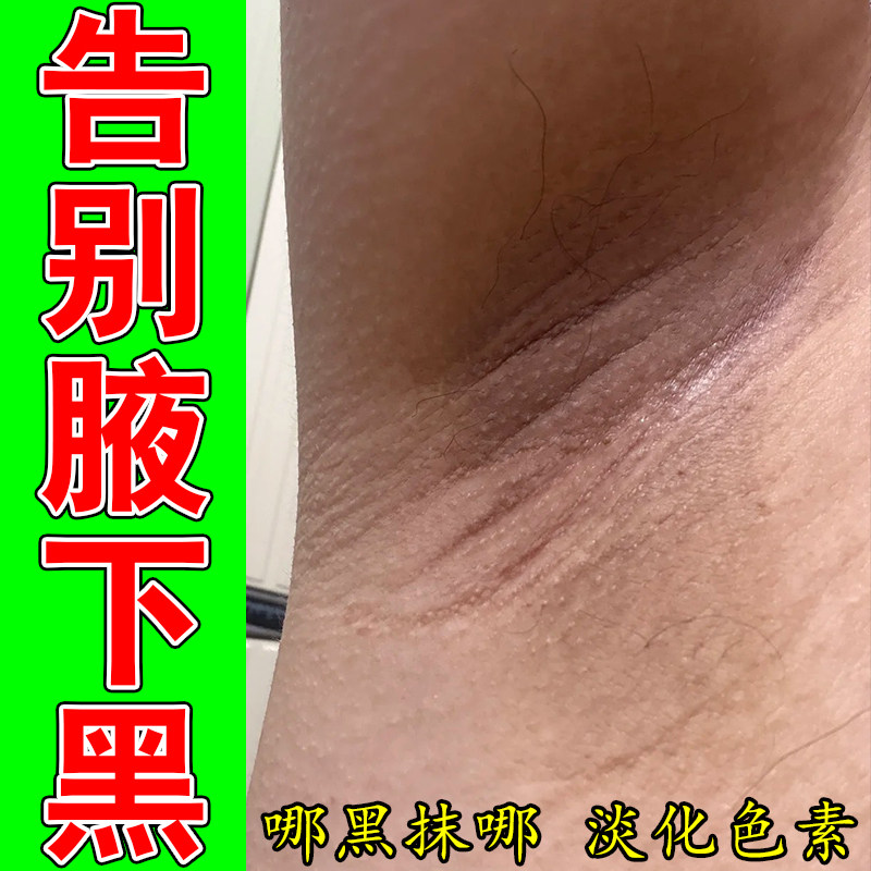 除腋下黑暗沉发黑腋窝粗糙胳肢窝暗沉腋下褶皱色素堆积按摩膏