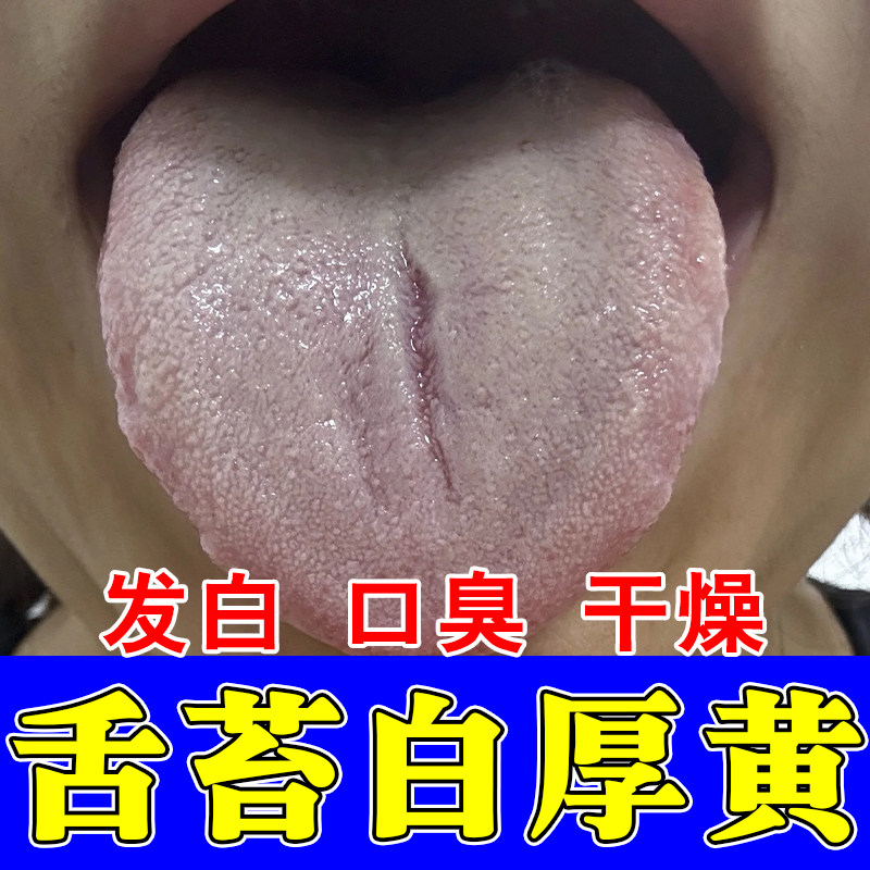 冶舌苔白厚口臭调理舌头裂纹白腻发厚黄调理脾胃湿气重口腔喷剂
