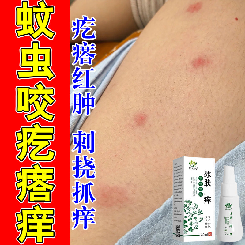 冶宝宝身上皮肤痒干燥粗糙腿部起红疙瘩蚊虫叮咬长红点干痒喷剂