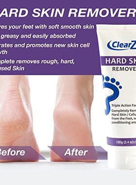 新品Clearzal hFoot Cream For Hard Skin  Helps Calluses and C