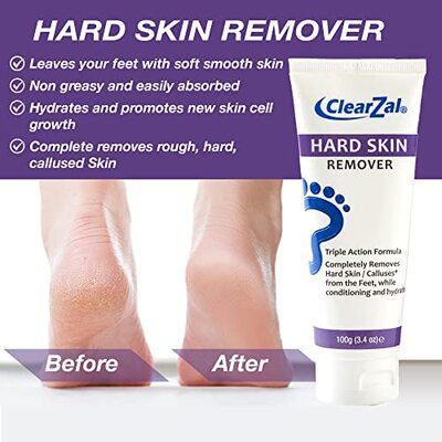 新品Clearzal hFoot Cream For Hard Skin  Helps Calluses and C