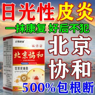 日光性皮炎特效膏药脸脖子太阳晒伤皮肤发痒紫外线过敏专用修复霜