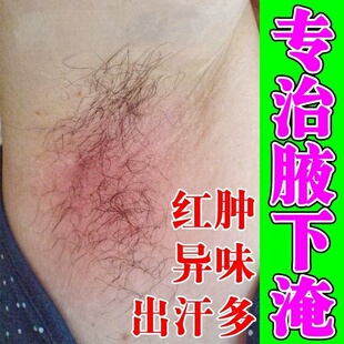 腋下淹红胳肢窝出汗发臭起疙瘩蛰痛腋窝长红疹痒刺痛放摩擦
