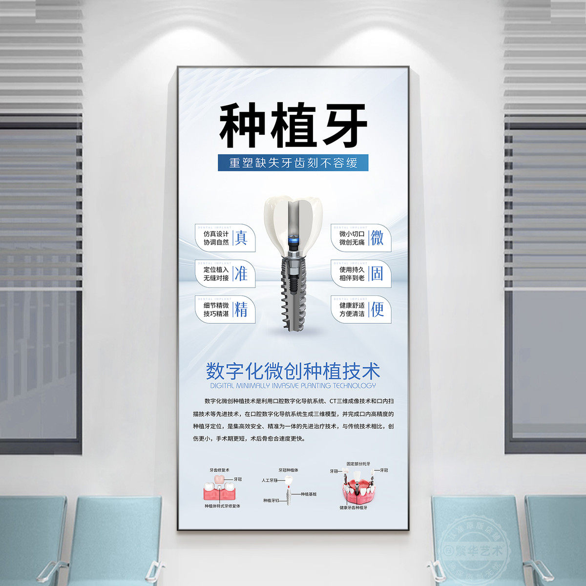牙科医院诊室文化宣传广告墙装饰画口腔诊所牙齿种植矫正美牙挂画