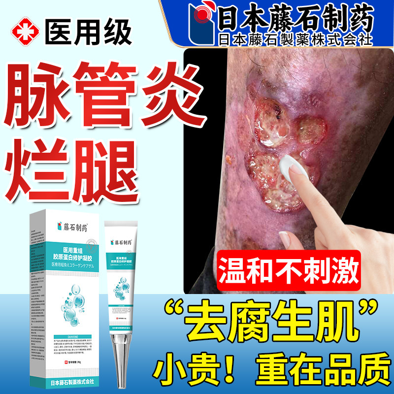 脉管炎老烂腿专特用膏贵愈合去腐生肌下肢静脉曲张药监备案XP