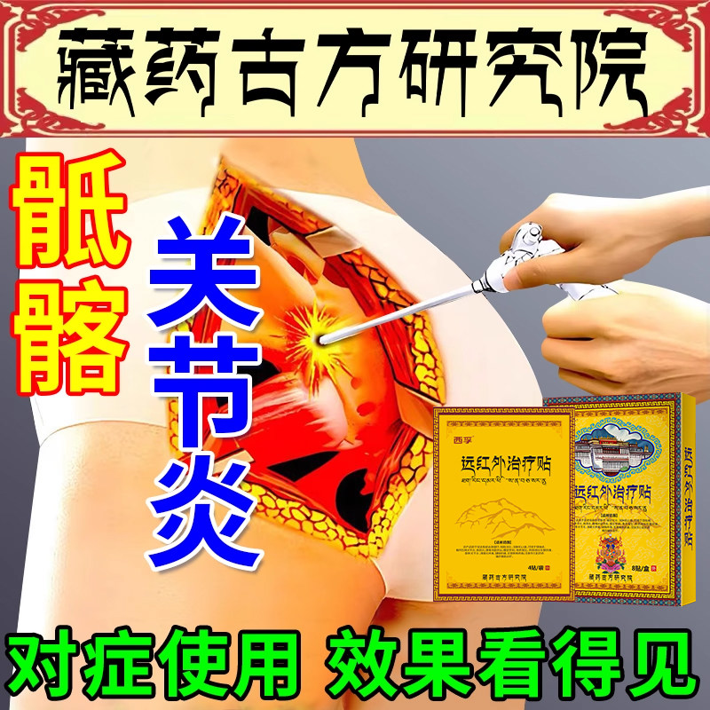 骶髂关节炎专用膏药贴髋关节疼痛股骨头坏死热敷理疗贴XP