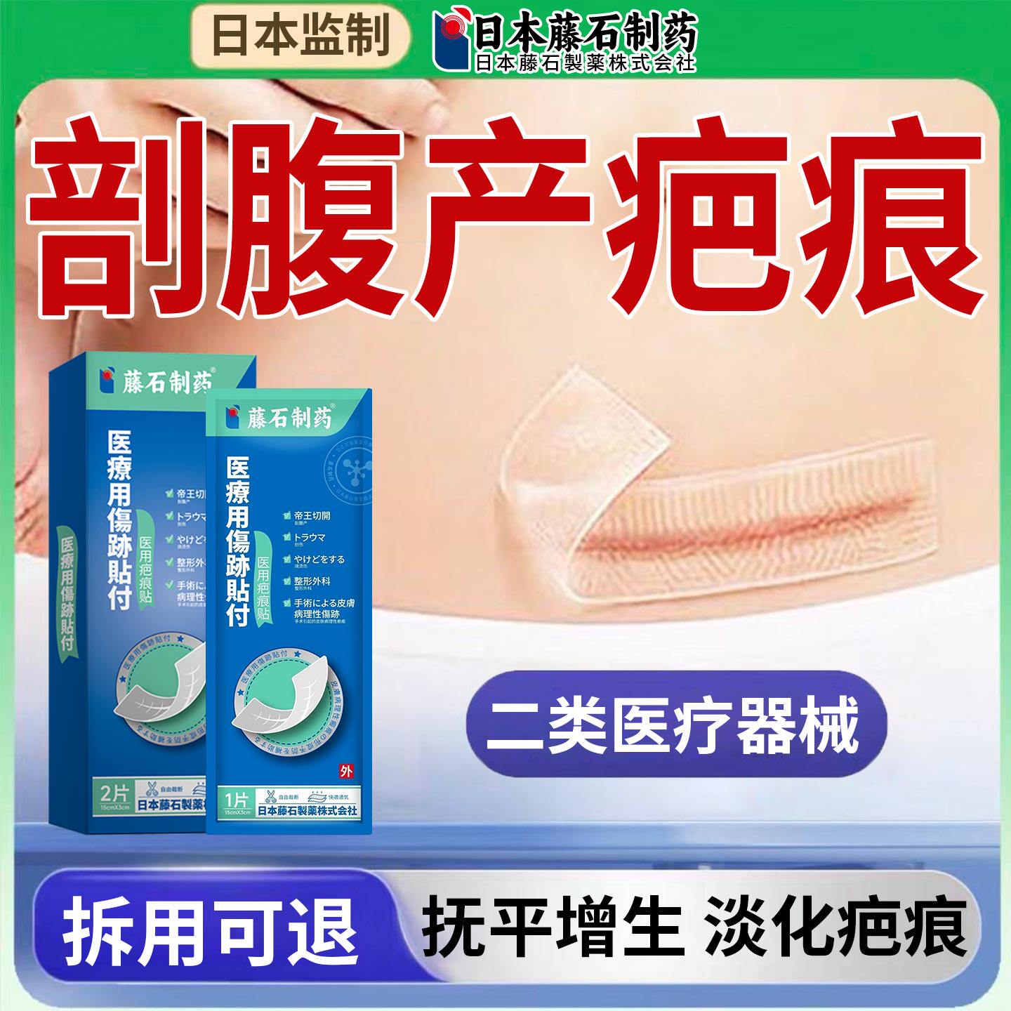 剖腹产术后淡化疤痕贴TS