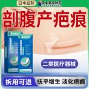 剖腹产术后疤痕祛疤产品淡化疤痕凸起增生可搭疤痕修复贴TS