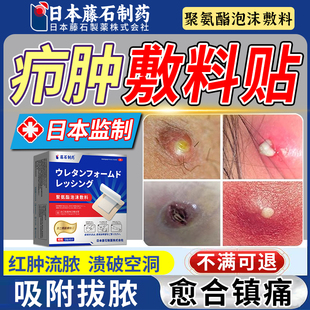 疖肿贴火疖子敷料贴疖肿拔毒拔脓膏屁股上脓包硬块疙瘩可搭药膏XP