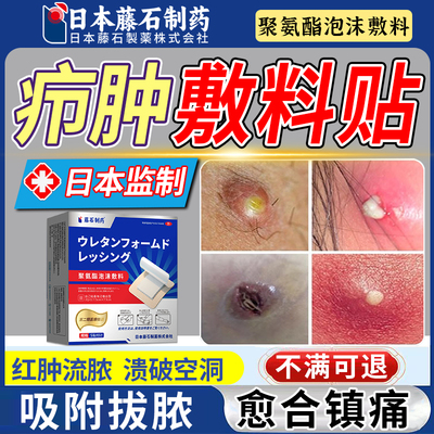 疖肿火疖子专用聚氨酯泡沫敷料贴