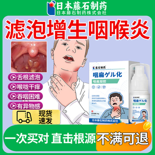 滤泡增生咽炎神器咽喉炎喷雾剂慢性咽炎专用舌根喉咙发炎异物感XP