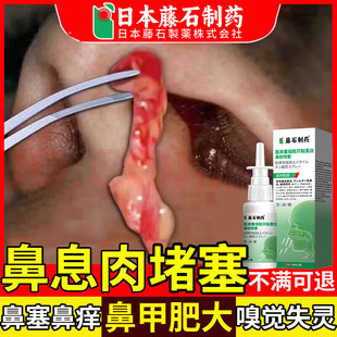 鼻息肉脱落喷雾剂专特用效治疗鼻息肉堵塞鼻甲肥大的中药监备案BD