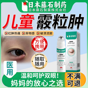 儿童霰粒肿引起干眼症热敷可搭贴蒸汽眼罩睑板腺囊肿麦粒肿凝胶xu