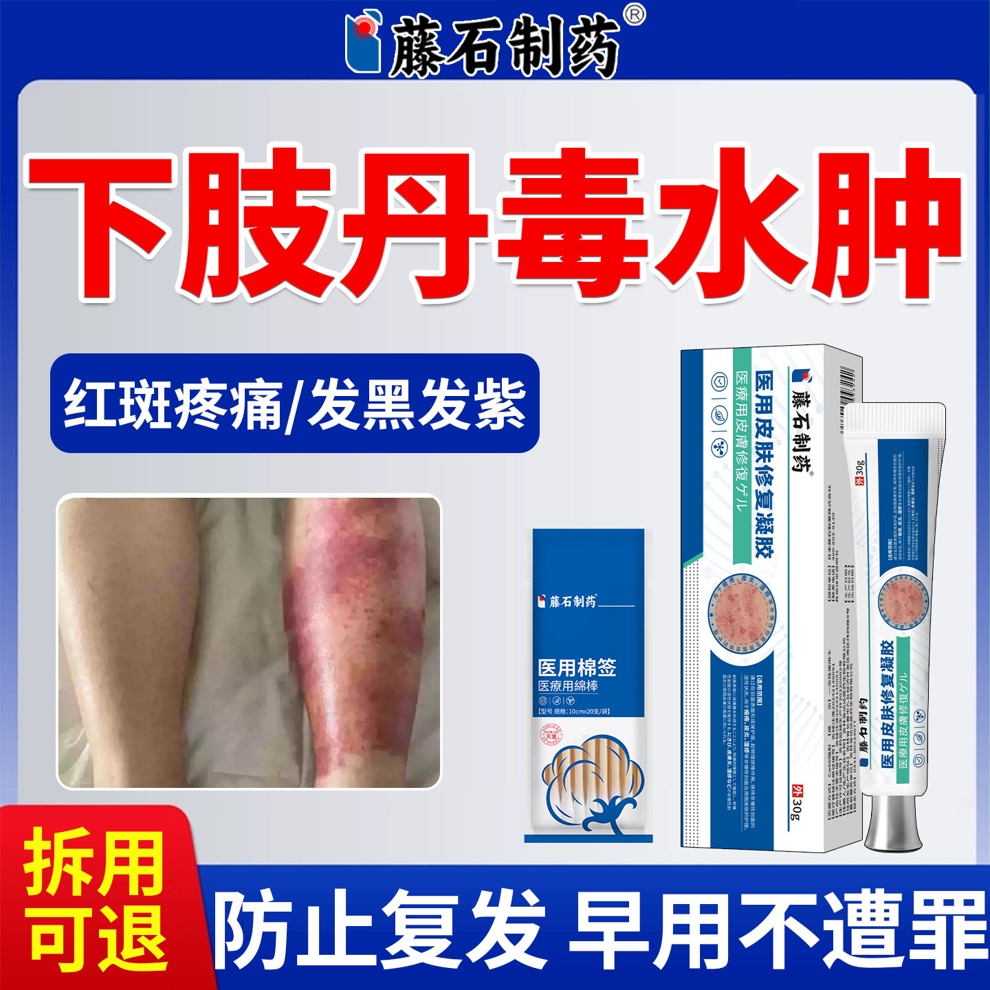 丹毒专用消肿软膏小腿红斑疼痛修复治疗下肢红肿灼热可搭膏药贴XP