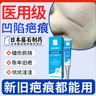 凹陷性疤痕祛疤膏生长因子去水痘痘坑凹洞修复填充去凹凸疤痕膏XP