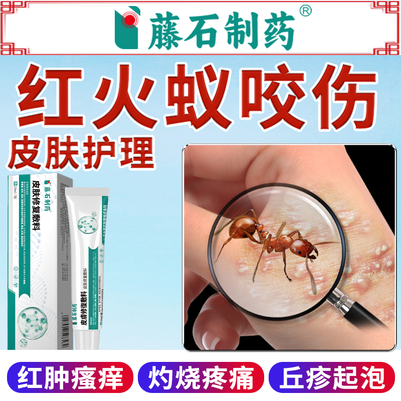 德国品牌蚂蚁蚊虫叮咬止痒消肿膏