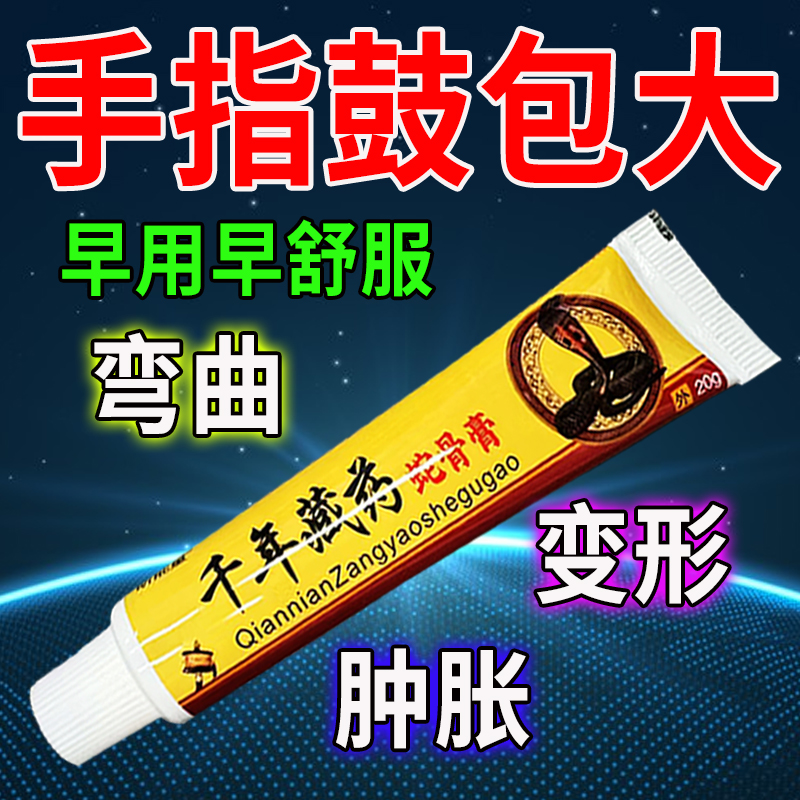 类风湿性关节焱手指关节变形肿大粗大增生疼痛酸麻僵硬乳膏