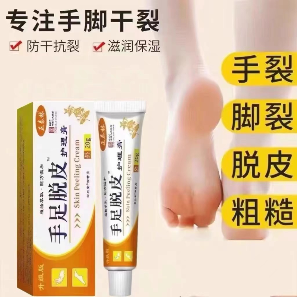手足脱皮膏护肤膏手指上起皮干燥脱皮脚底防手干裂膏皮肤真菌