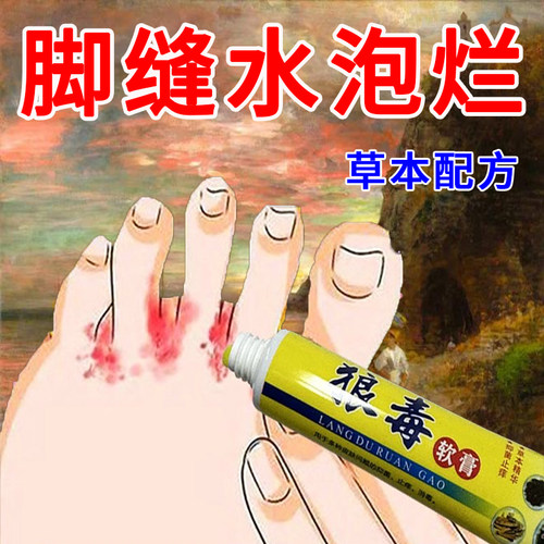 狼毒本草去真菌脚痒水泡脱皮烂脚丫脚缝部干燥清爽除臭膏