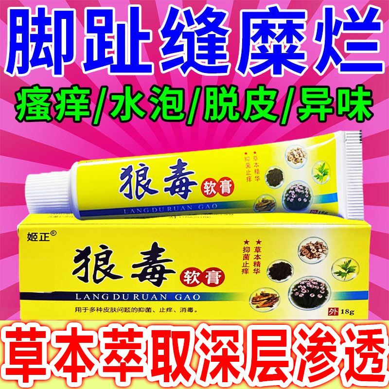 狼毒蚊虫叮咬止痒脚臭脚痒屁股上长痘痘痒久坐私处止痒膏